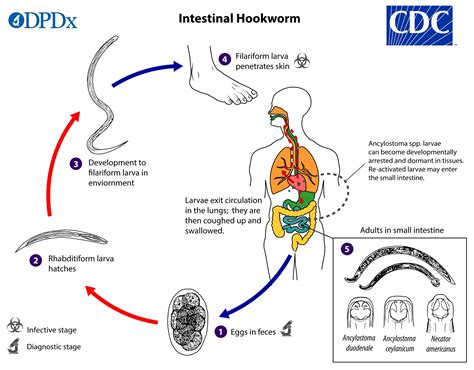  Xiphidiocercaria: Parasitize This Tiny Worm With Its Astonishing Lifecycle!