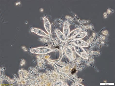  Zoothamnium! The Intriguing Microbial World of Stalked Ciliates